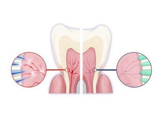 牙齿敏感的原因